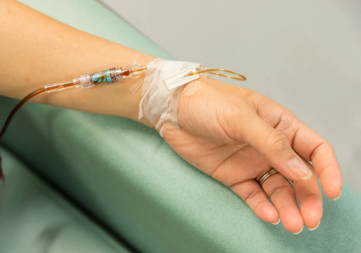 Kroplówki witaminowe Iława: dłoń z wenflonem i linią infuzyjną na podkładzie